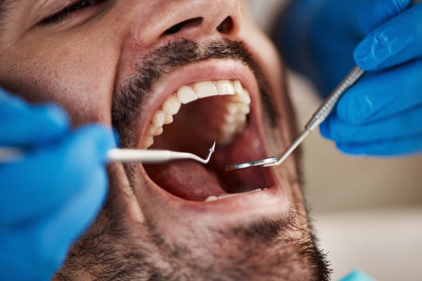 Best Root Canal Treatment  in Baraboo, WI